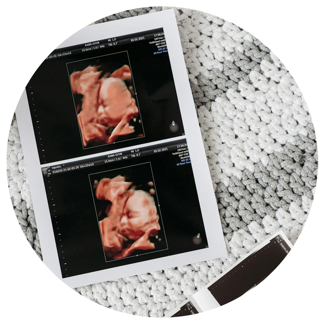 De echo van je baby, vaak ook wel een zwangerschapsecho genoemd