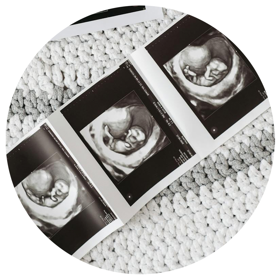 Wat Kun je Zien op de Echo van je Baby